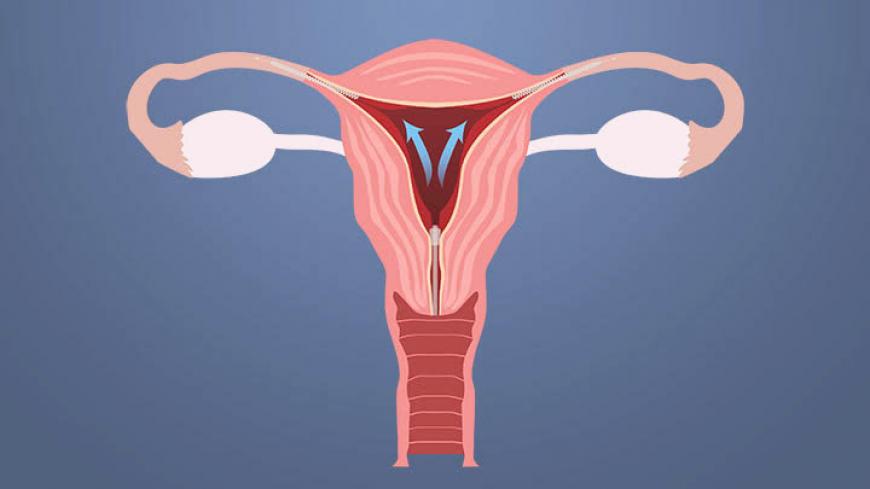 how Essure product works